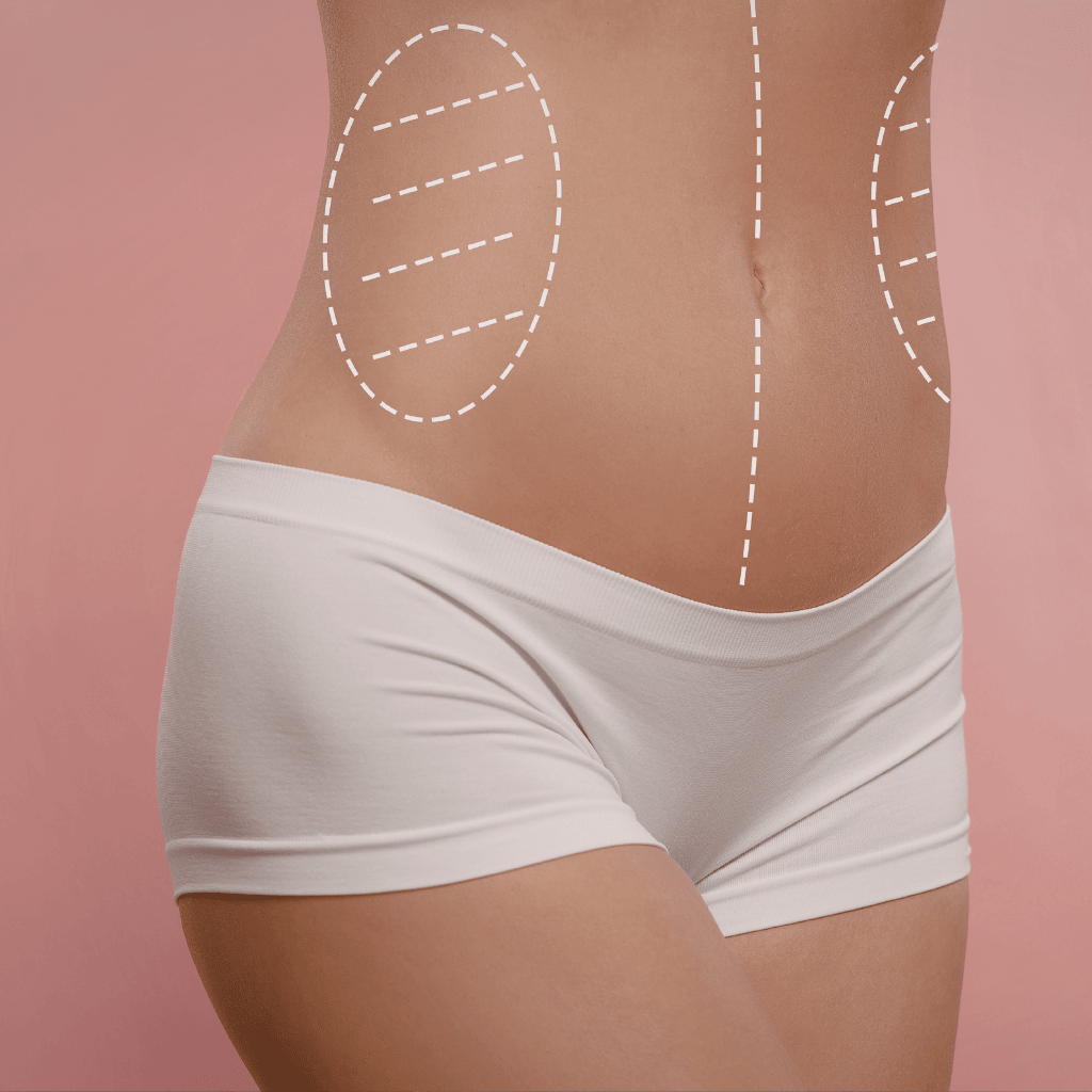 Remodelación corporal